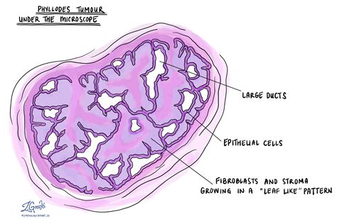 Breast conditions : 네이버 블로그