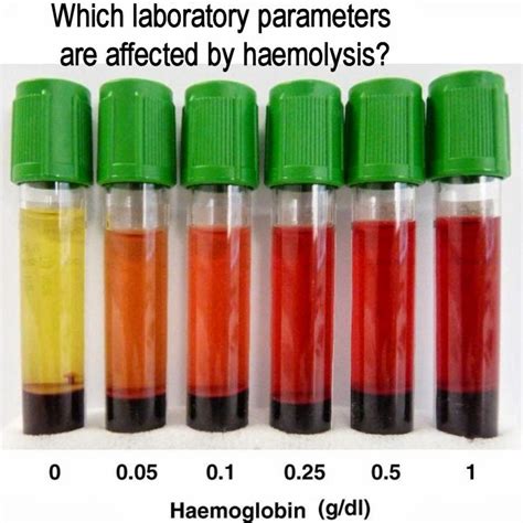 Pin on Medical Laboratory and Biomedical Science