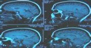 Health & Medical News - Brain rhythms reveal chaos - 23/08/2001