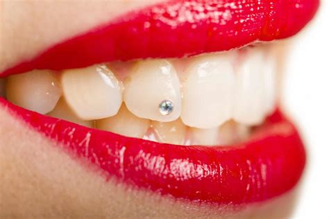 How Much Does It Cost To Put A Diamond In Your Teeth? | Dental Care Report