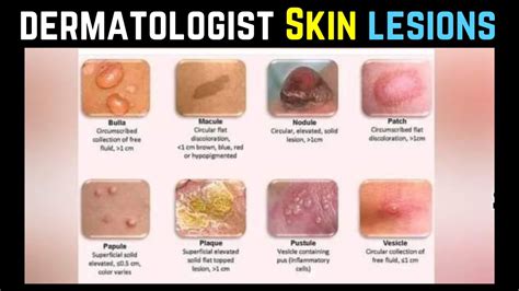 Printable Skin Lesion Guide Dermatology