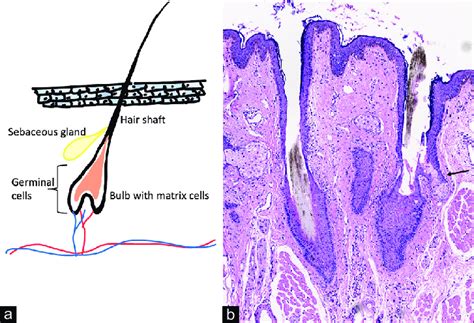 Schematic representation of a pilosebaceous unit of the eyelash.... | Download Scientific Diagram