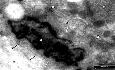 Electron micrograph of hepatic stellate cell (ST) seen in the Disse ...