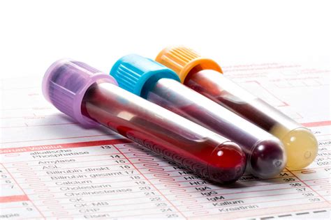 Blood testing tubes — Stanford Blood Center