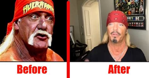 Hulk Hogan looks decades younger following plastic surgery