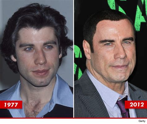 John Travolta: Good Genes or Good Docs?