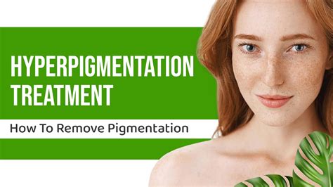 Hyperpigmentation Treatment - How To Remove Pigmentation by Kosmoderma Clinic - Issuu