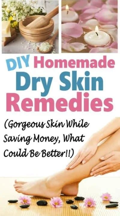 DIY Homemade Dry Skin Remedies ~ Save money with these easy DIY remedies