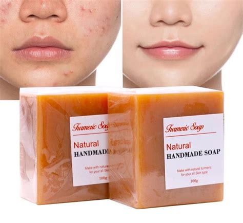 2pcs natural turmeric dark spot anti acne facial soap | Etsy