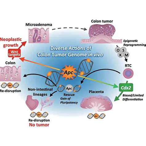 Adenomatous Polyposis Coli (APC) - Gene Mutation Test in Delhi NCR ...