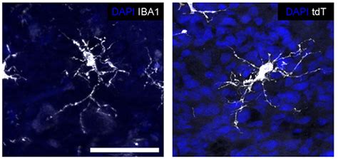 Brain Within a Brain? Nested Organoids a New Way to Study Human Microglia | ALZFORUM