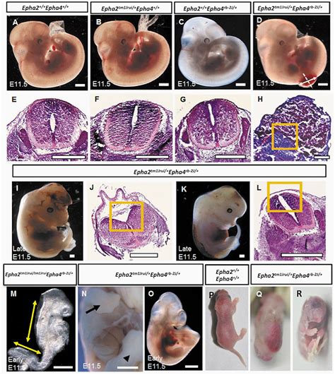 Frontiers | A Novel Occulta-Type Spina Bifida Mediated by Murine Double Heterozygotes EphA2 and ...