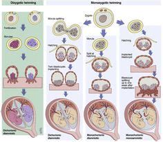 Heteropaternal Superfecundation Are Twins With Different Fathers | Types of twins, Fraternal ...