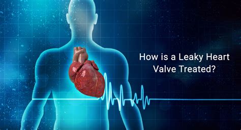 How is a Leaky Heart Valve Treated? : Eternal Hospital