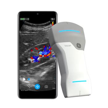 GE Vscan Air Ultrasound Machine For Sale Or Rent — Ultrasounds MD