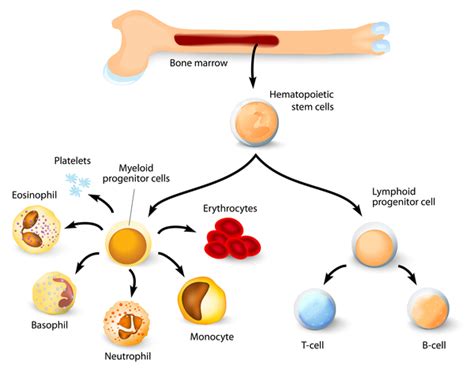 Chronic granulomatous disease: MedlinePlus Genetics