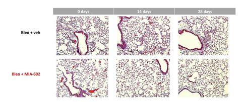 Growth hormone-releasing hormone receptor antagonists for cancer ...