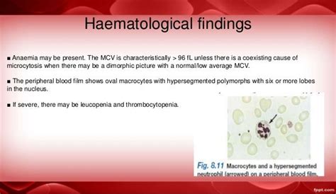 Macrocytic Anemia