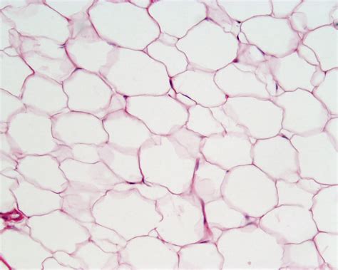 Biologizing: Using Stem Cells Derived from Adipose Tissue to Regenerate ...