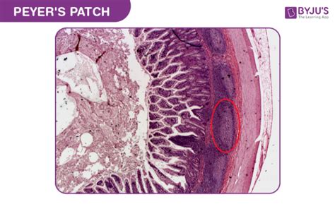 Patches and Folds - Peyer's Patches, Location, Shape, Function, Folds