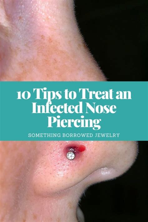 10 Tips to Treat an Infected Nose Piercing | Nose piercing infection ...