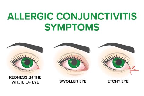 Signs and Symptoms of Pink Eye (Conjunctivitis)