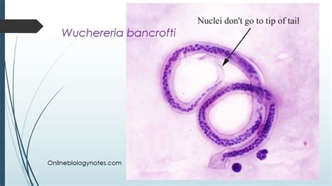 Wuchereria bancrofti: Morphology, life cycle and Epidemiology - Online Biology Notes