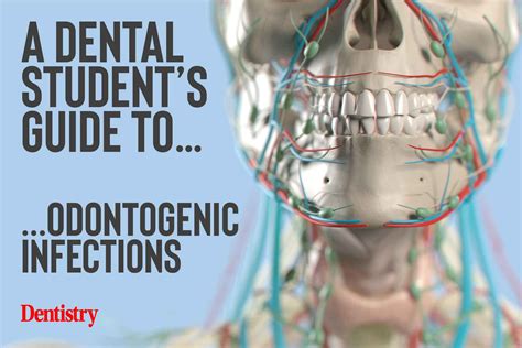 A dental student's guide to...odontogenic infections - Dentistry