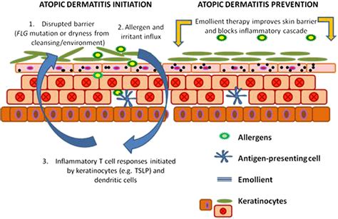 Emollient enhancement of the skin barrier from birth offers effective ...