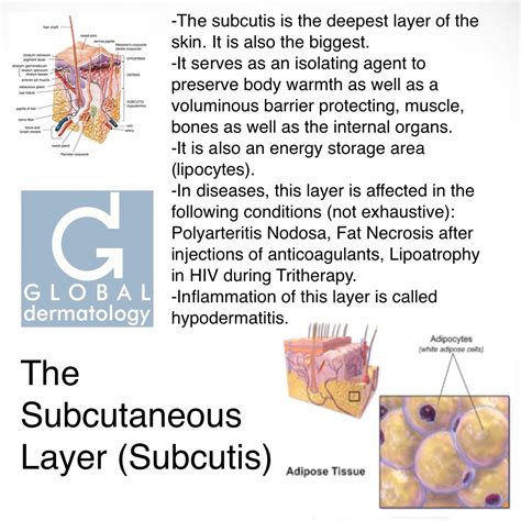 Global Dermatology » Subcutaneous Layer (Subcutis) (Instagram)