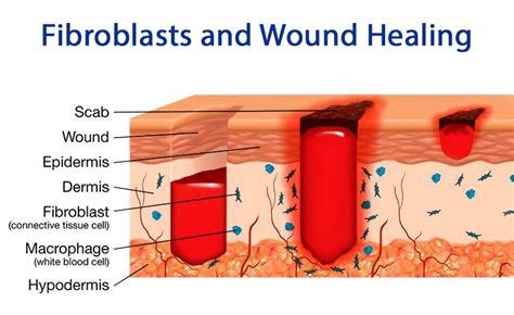 Wound Healing Diagram