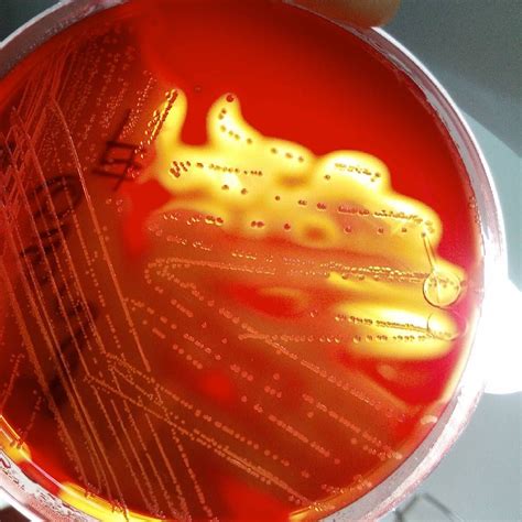 Carolina Macero. on Instagram: “Enterococcus faecalis. Agar sangre, a ...