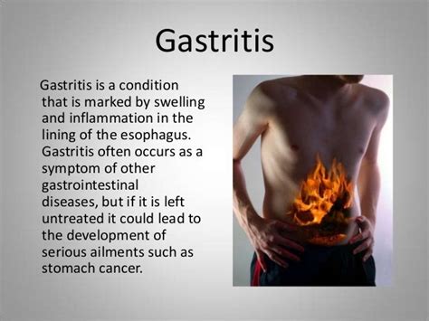 Gastroenterology Diseases