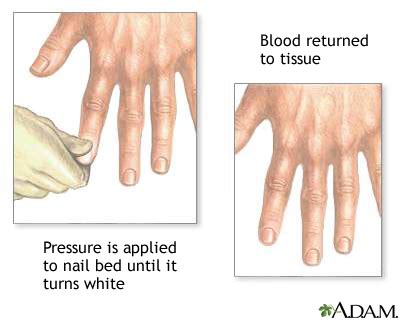 Capillary nail refill test | UF Health, University of Florida Health