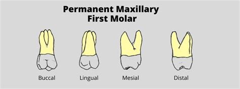 Permanent Maxillary First Molar: Tooth Morphology Made Easy! | Dental ...