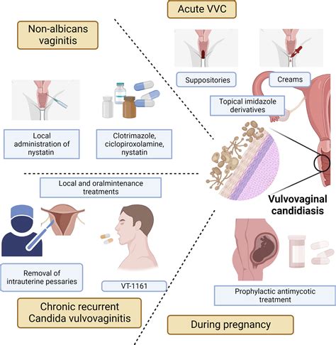 Novel Antifungals For The Treatment Of Vulvovaginal, 51% OFF