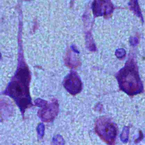 Strangulation Asphyxia Causes Shrinkage and Hyperchromia of Neurons in The Cerebral Cortex of ...