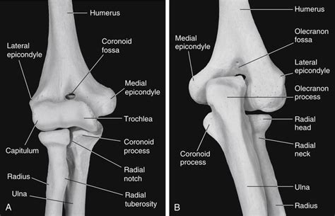 Elbow Diagnoses | Musculoskeletal Key