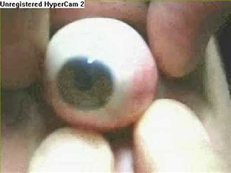 Eyeball pop out - YouTube