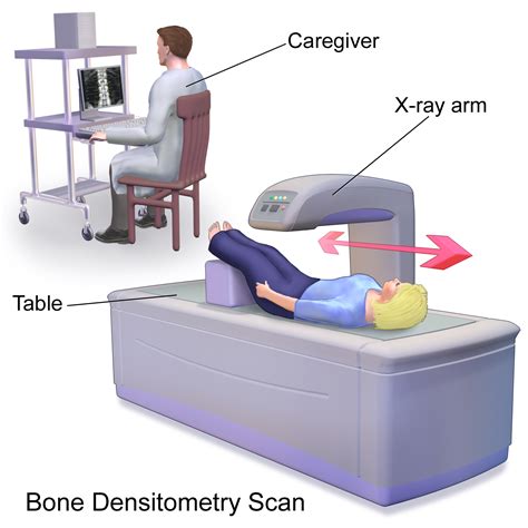 Bone Densitometry