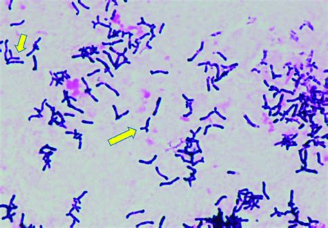 Gram-positive rods at 1,000 x magnification from a blood culture bottle... | Download Scientific ...