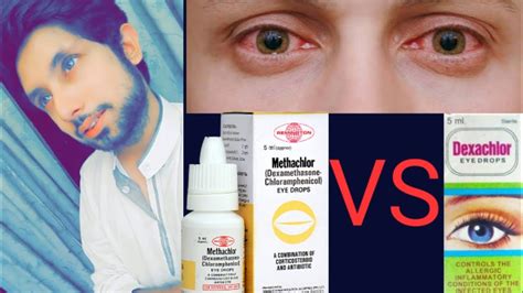 How to cure eye infection,review of methachlor, review of dexachlor eye ...