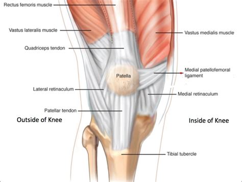 Medial Patellar Retinaculum - a fibrous expansion comprising of superficial and deep layers. The ...