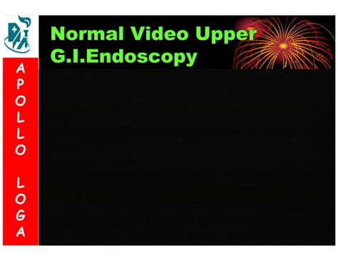 Upper GI Endoscopy - A pictorial overview | PPT