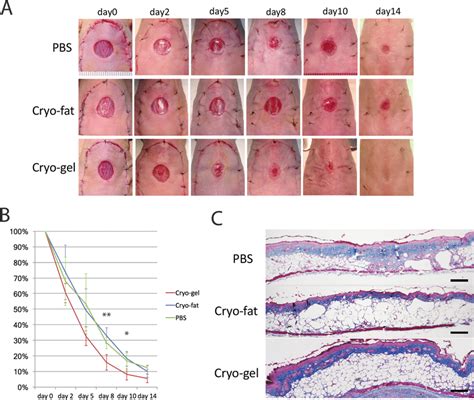 Regenerative potential of the cryo-gel in an ischemic wound healing... | Download Scientific Diagram