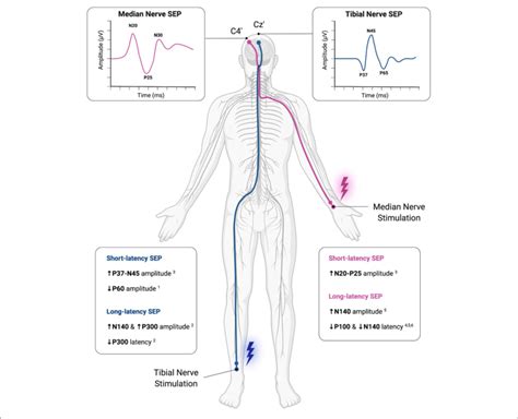 | Methodological overview of somatosensory-evoked potential (SEP)... | Download Scientific Diagram