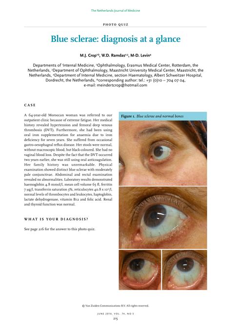 (PDF) Blue sclerae: diagnosis at a glance