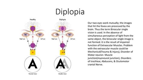 Orbital complications of zygomaticomaxillary complex fracture | PPT ...