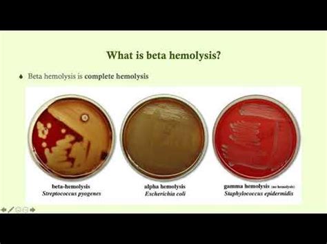 Group A Beta-Hemolytic Strep (S. pyogenes) - Microbiology Boot Camp - YouTube