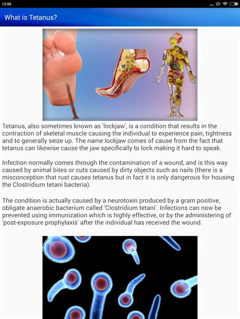 Clostridium Tetani Symptoms